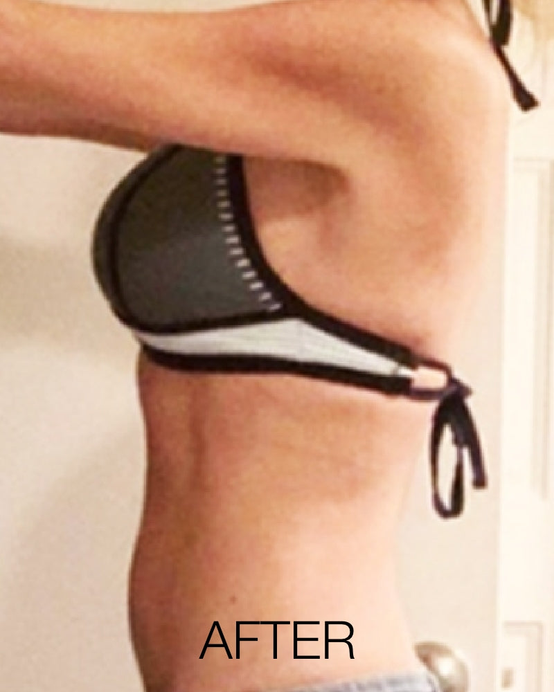 Service Voucher - Semaglutide/GLP-1, 3-month Weight Loss Program + FREE $50 Total Med Gift Card