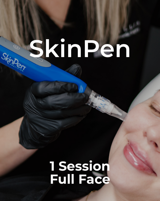 One (1) SkinPen Treatment – Full Face