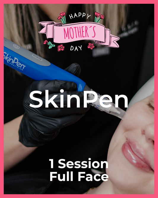 One (1) SkinPen Treatment – Full Face