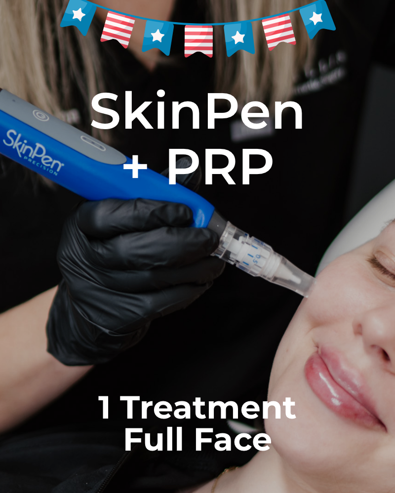 One (1) Treatment of SkinPen + PRP – Full Face