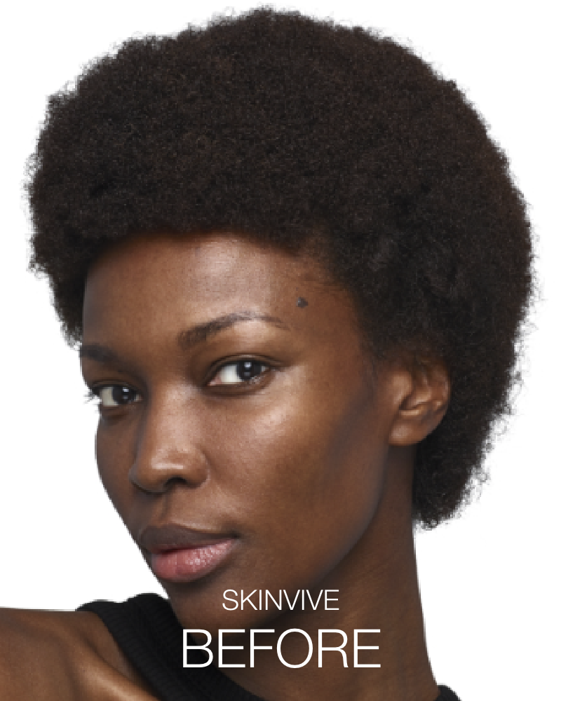 Service Voucher - Glass Skin Package: 2 Syringes of SKINVIVE & 44 Units of Botox