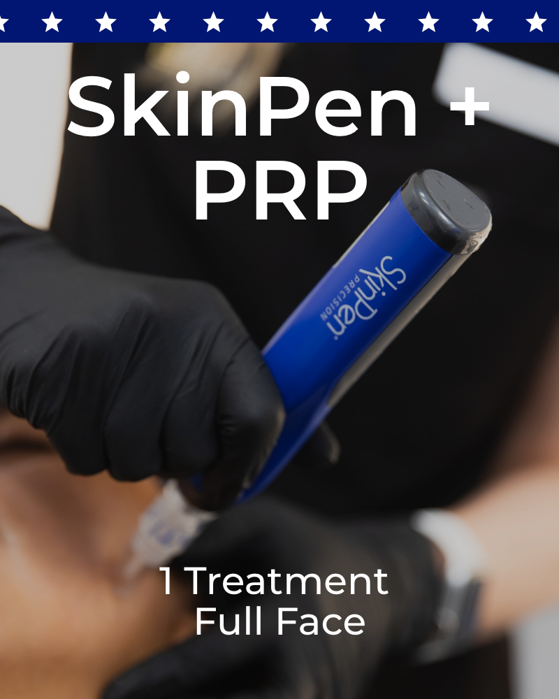 One (1) Treatment of SkinPen + PRP – Full Face
