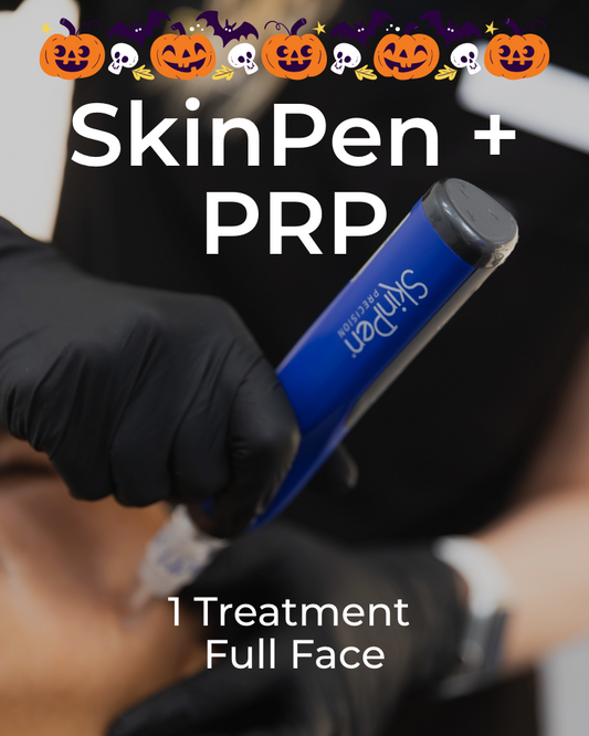 One (1) Treatment of SkinPen + PRP – Full Face