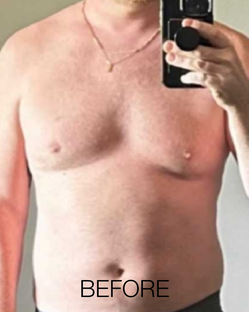 Service Voucher - Tirzepatide GLP-1, GIP 8-Week Program + FREE $50 Total Med Gift Card