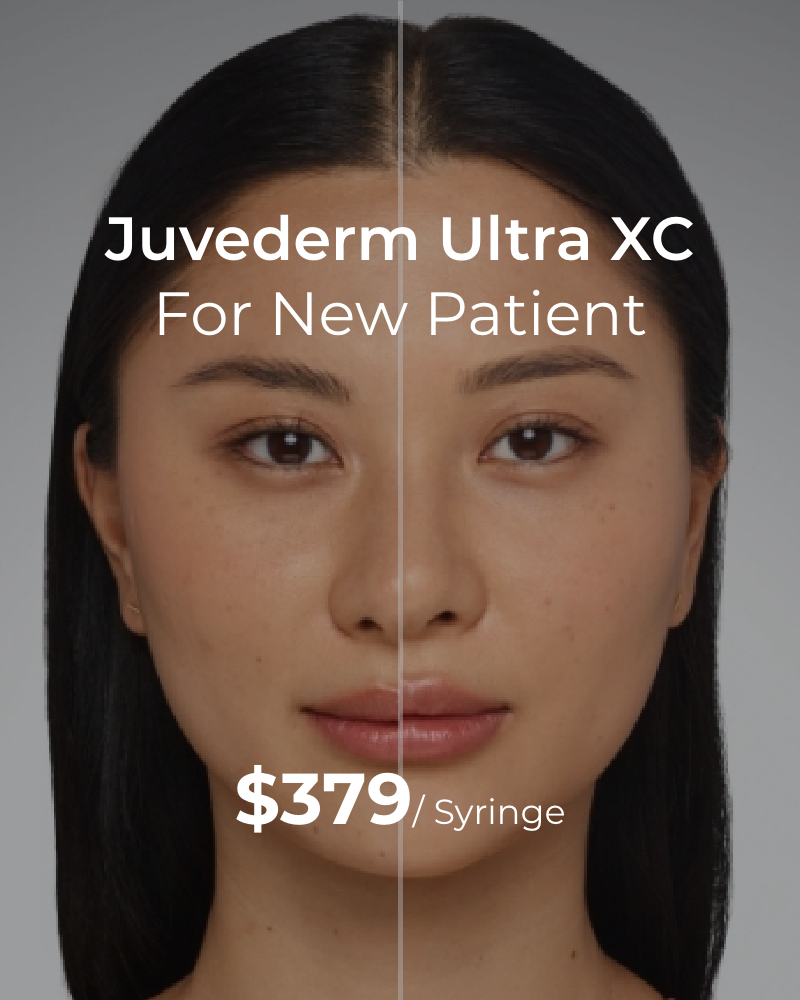 Service Voucher - Juvederm Ultra XC - 1ml Syringe