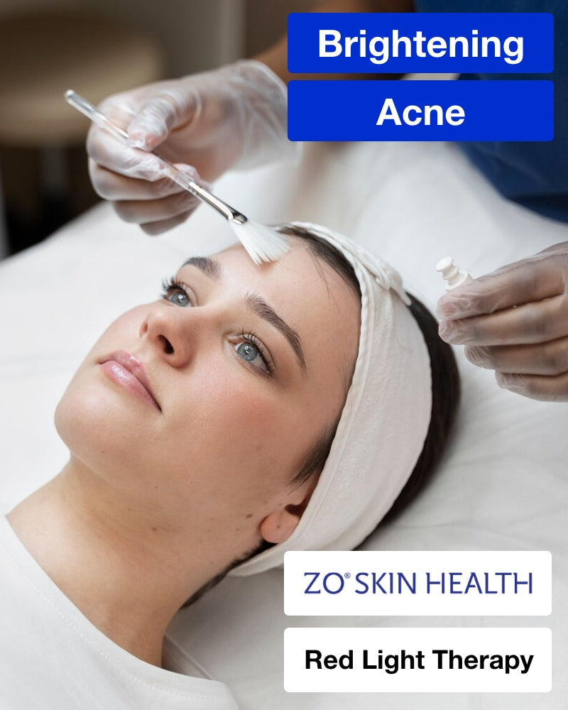Service Voucher - Three (3) ZO® Stimulator Chemical Peel + Red Light Therapy
